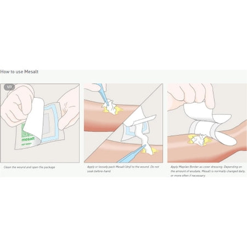 mesalt sodium chloride impregnated dressing 6 x 6 inch mesalt sodium chloride impregnated dressing mk400463bx