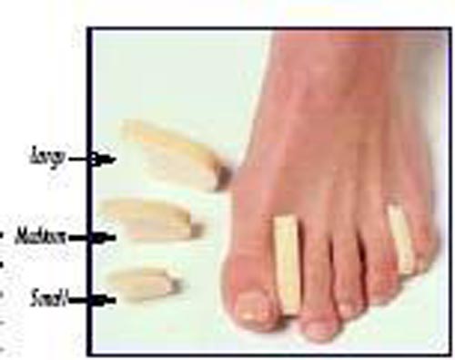 Toe Separator Large Bx/12 - All Care Store 